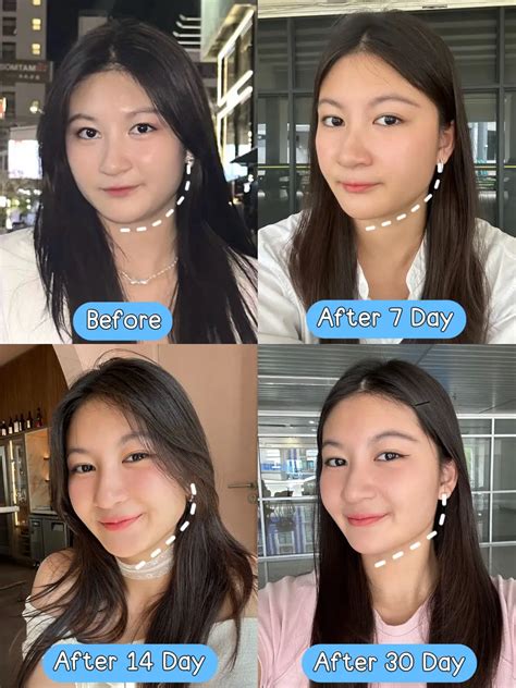 ฉีดหน้าครั้งแรกในชีวิต ปังแค่ไหน ⁉️ .